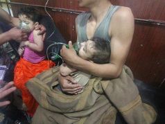 Сирийские дети, ставшие жертвами химатаки в Восточной Гуте (Дума). Фото: aa.com.tr